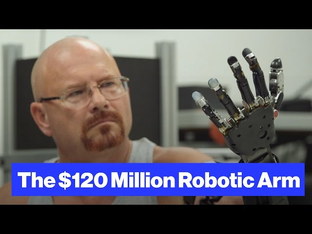 robotic prosthetic arm - The Robot-Arm Prosthetic Controlled by Thought - YouTube
