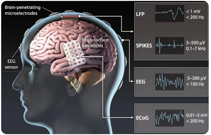 neural interface microelectrodes - Five Levels of Explanation (Part I): How Brain-Computer Interfaces ...